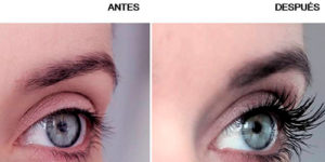 Schönere Augen nach der Behandlung mit Hitome