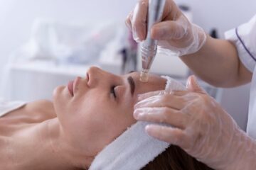 Microneedling-Behandlung mit einem Dermapen